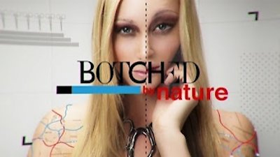 Botched by Nature Season 1 Episode 2