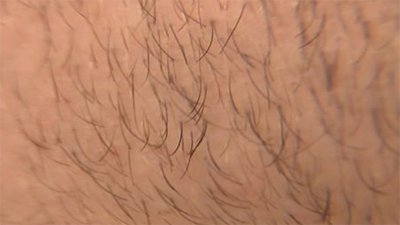 Evolve Season 1 Episode 5