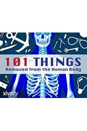 101 Things Removed from the Human Body