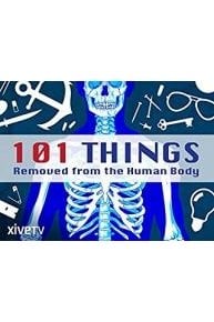 101 Things Removed from the Human Body