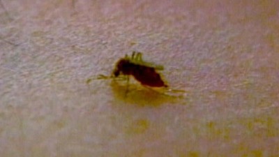 ABC Good Morning America Health Season 1 Episode 105