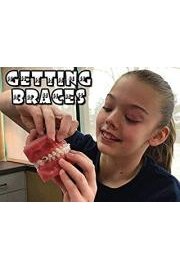 Getting Braces