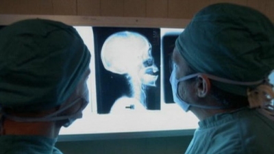 Simon & Simon Season 3 Episode 19