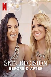 Skin Decision: Before and After