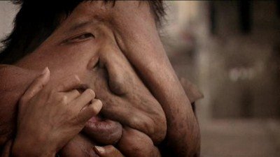 BodyShock Season 1 Episode 11