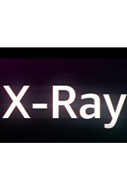 ROW Xray Test Series 1